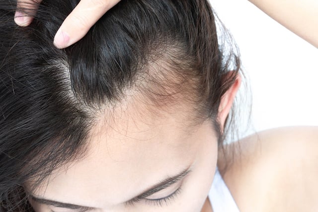 Hair thinning and hair health